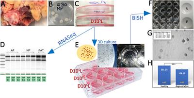 Glis1 and oxaloacetate in nucleus pulposus stromal cell somatic reprogramming and survival